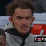 Trae Young balding