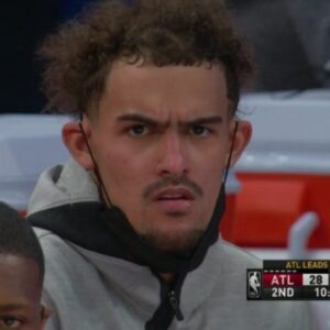 Trae Young balding
