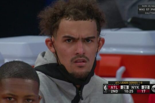 Trae Young balding